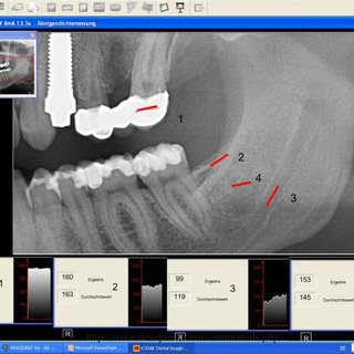 kodak dental imaging software viewer